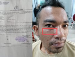 Ersada Gurusinga buat LP di Polsek Pancur Batu, karena tak terima Dianiaya